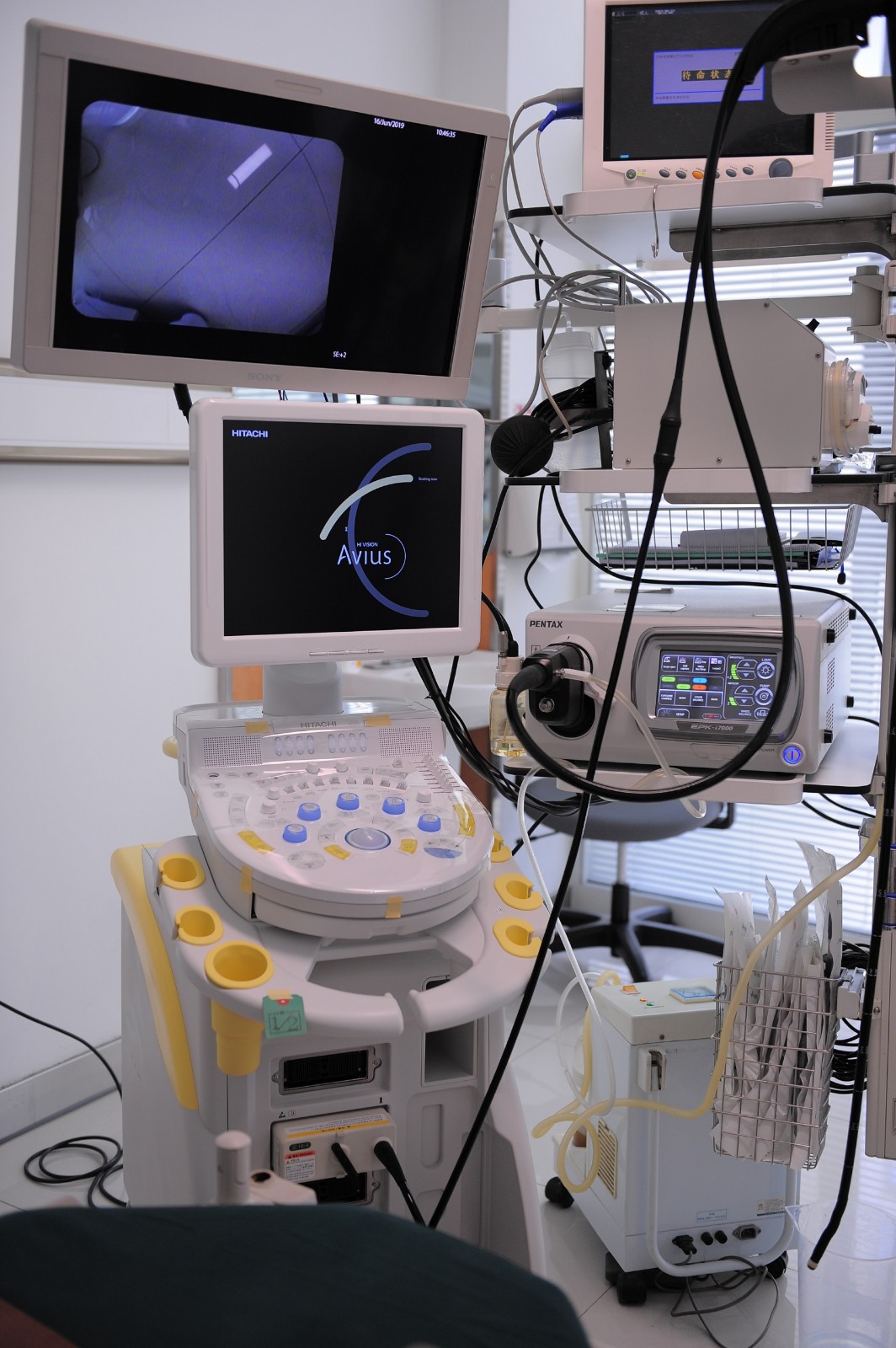 吉林国文医院最新引进日立彩超配合pentax超声内镜
